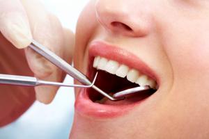 Địa chỉ nhổ răng khôn uy tín, an toàn nhất TP. Quy Nhơn, Bình Định