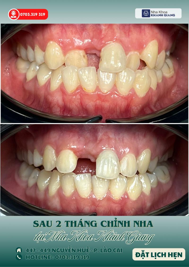 Nha Khoa Khánh Giang