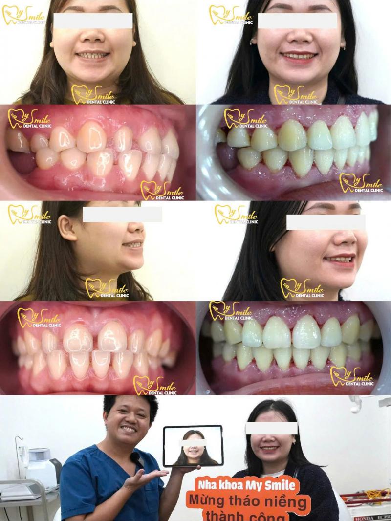 Nha Khoa My Smile