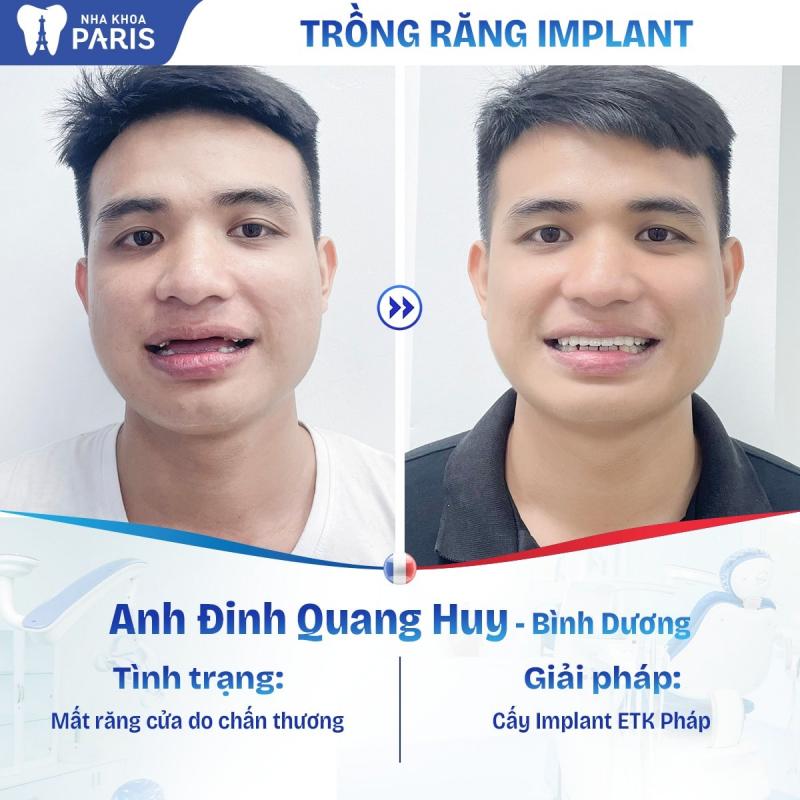 Nha Khoa Paris