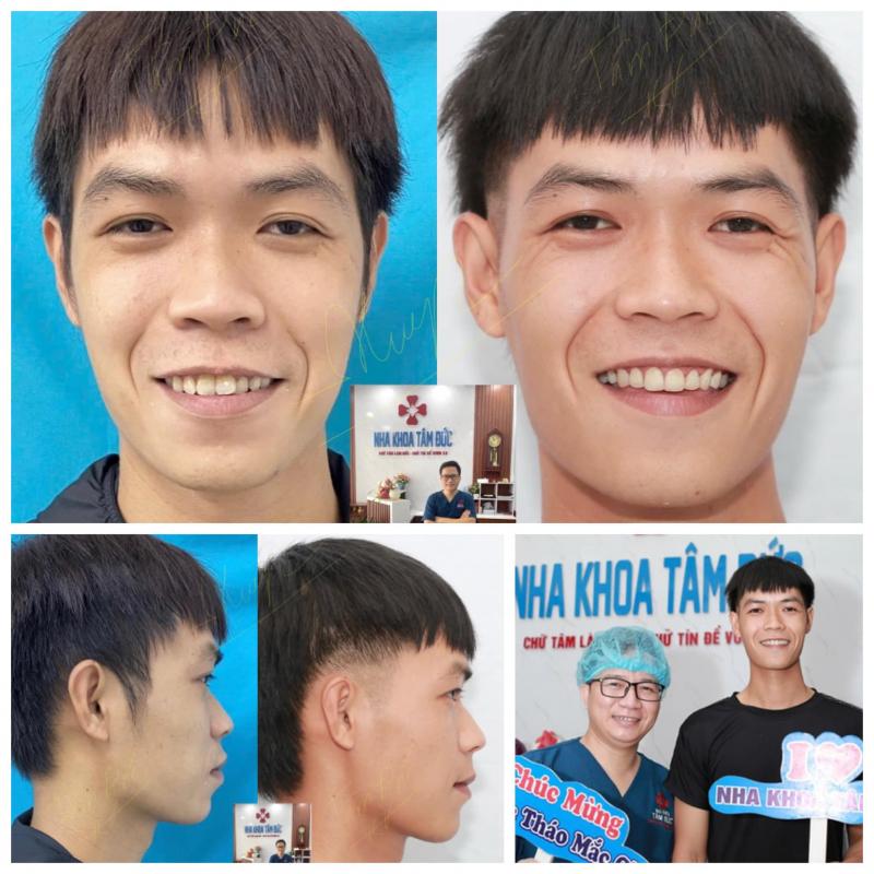 Nha Khoa Tâm Đức