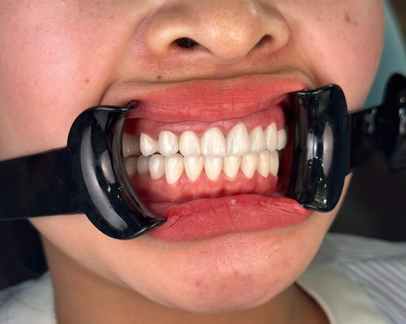 Nha Khoa Thẩm Mỹ Quốc Tế Thiện Nhân Lào Cai
