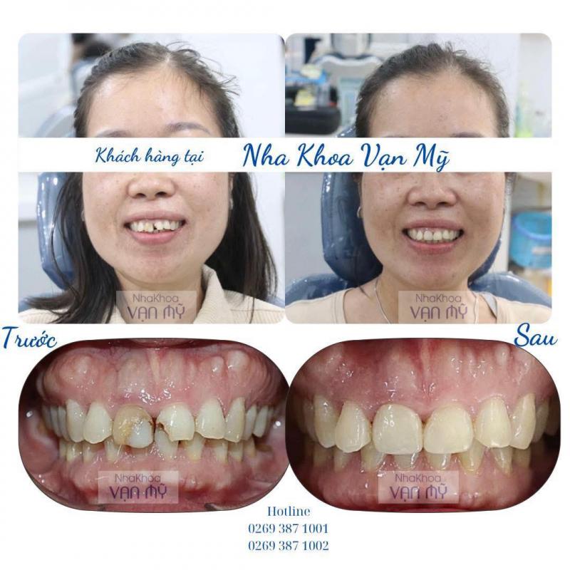 Nha Khoa Vạn Mỹ