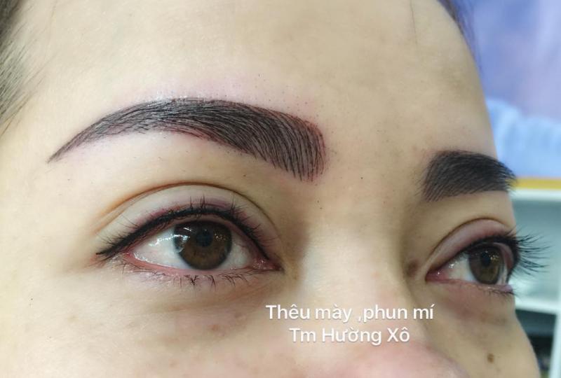 Thẩm Mỹ Hường Xô